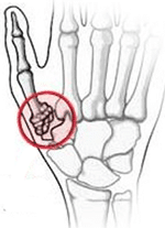 thumb joint hand graphic