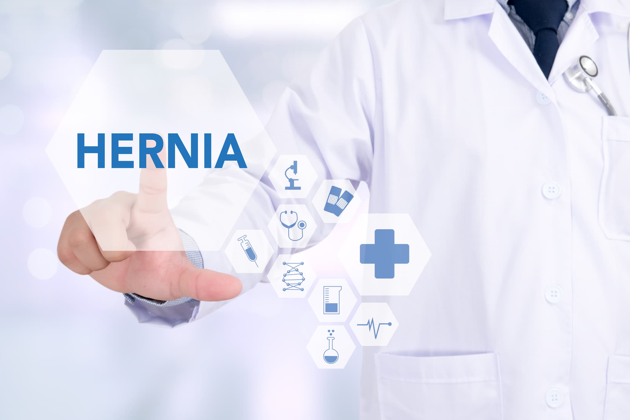 What You Should Know About Hernias